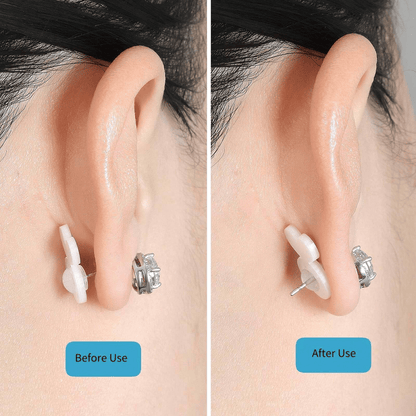 🔥2025 Neue Ohrringheber